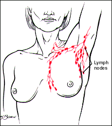 check for cancer in the breast